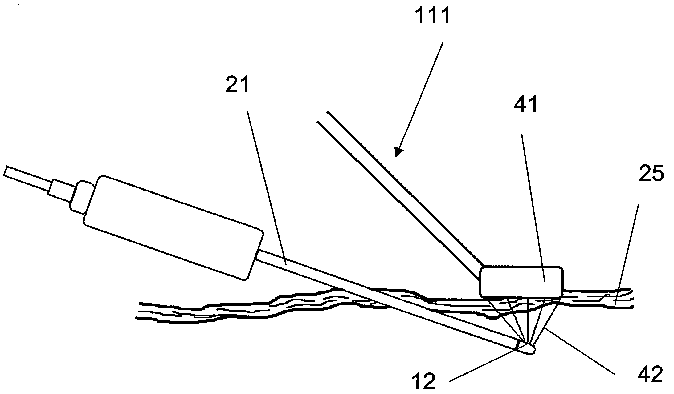 Method and device for minimally invasive skin and fat treatment