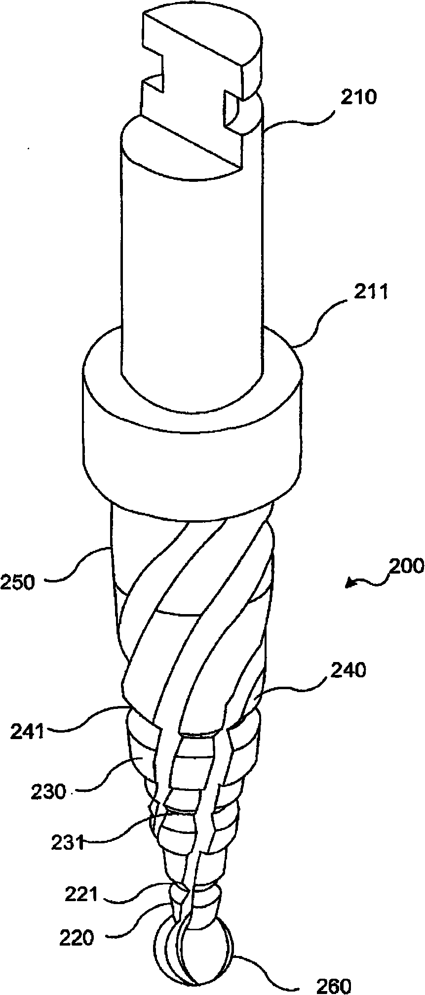 Dental implant method