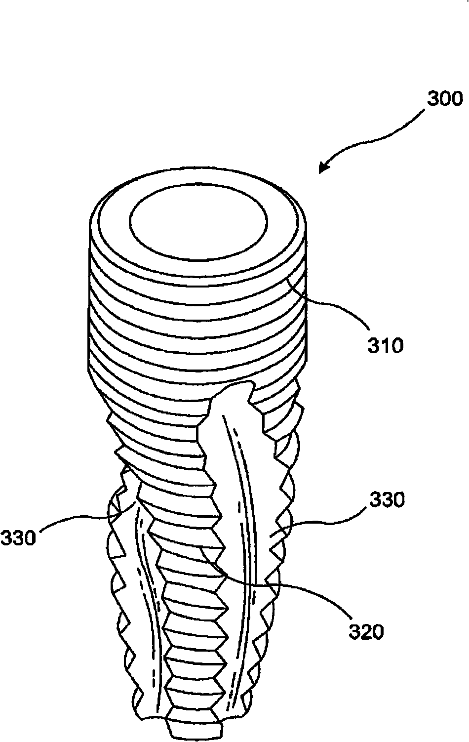 Dental implant method