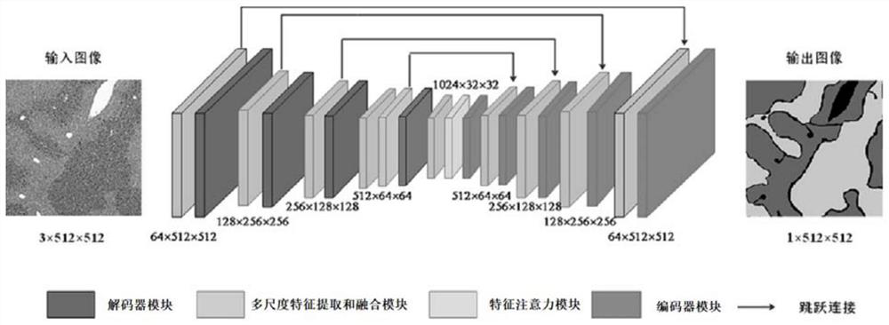 Liver pathological image segmentation model establishment and segmentation method based on attention mechanism