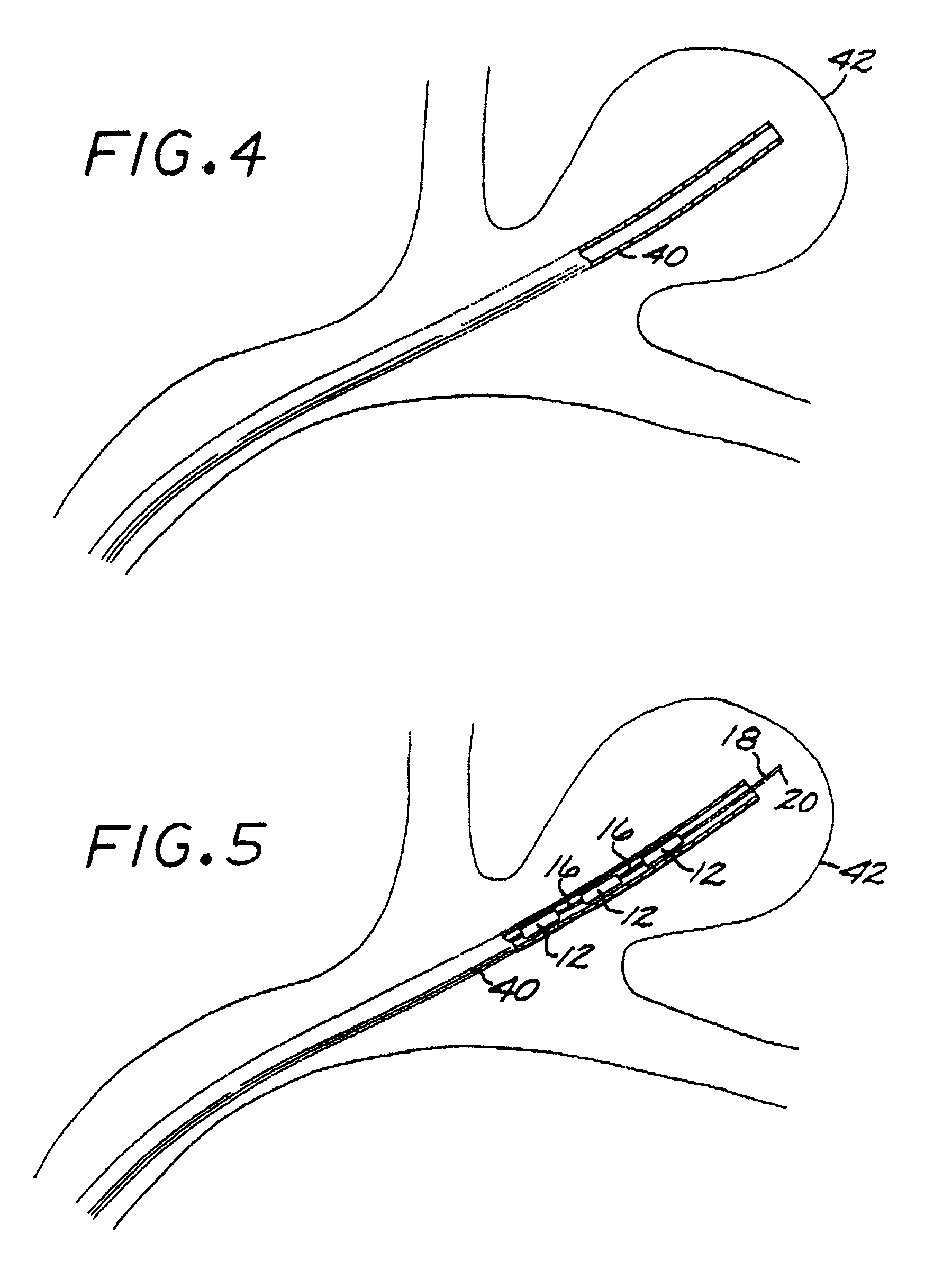 Method of manufacturing expansile filamentous embolization devices