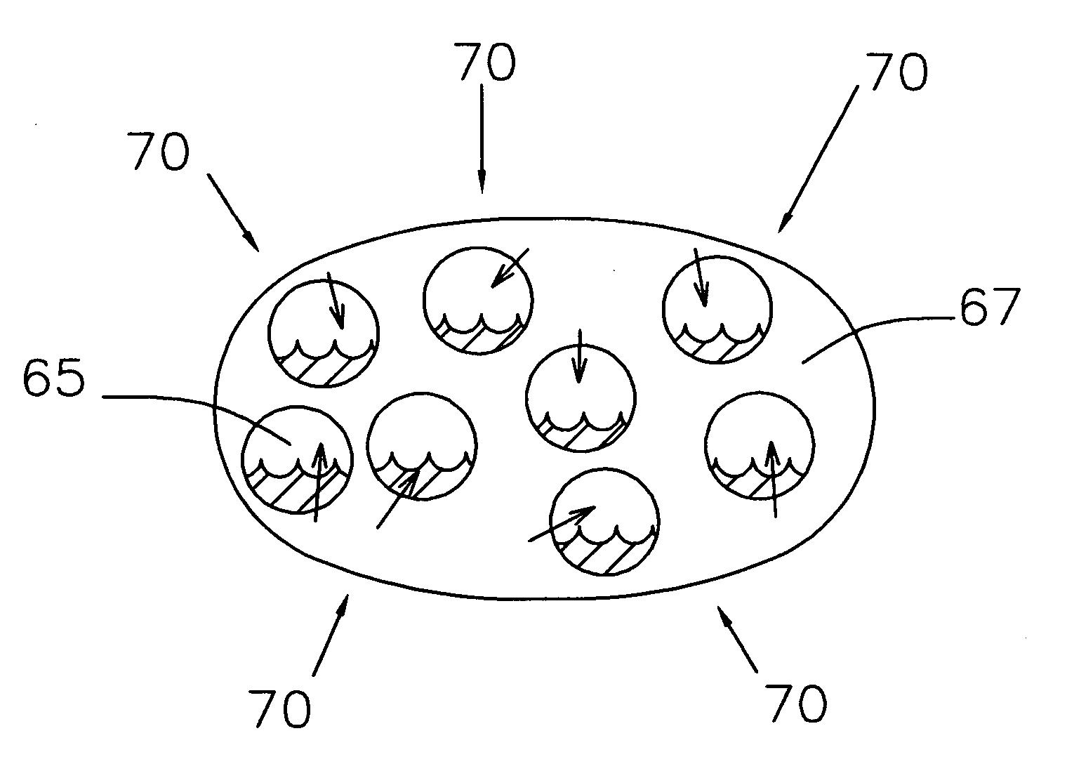 Closed system artificial intervertebral disc