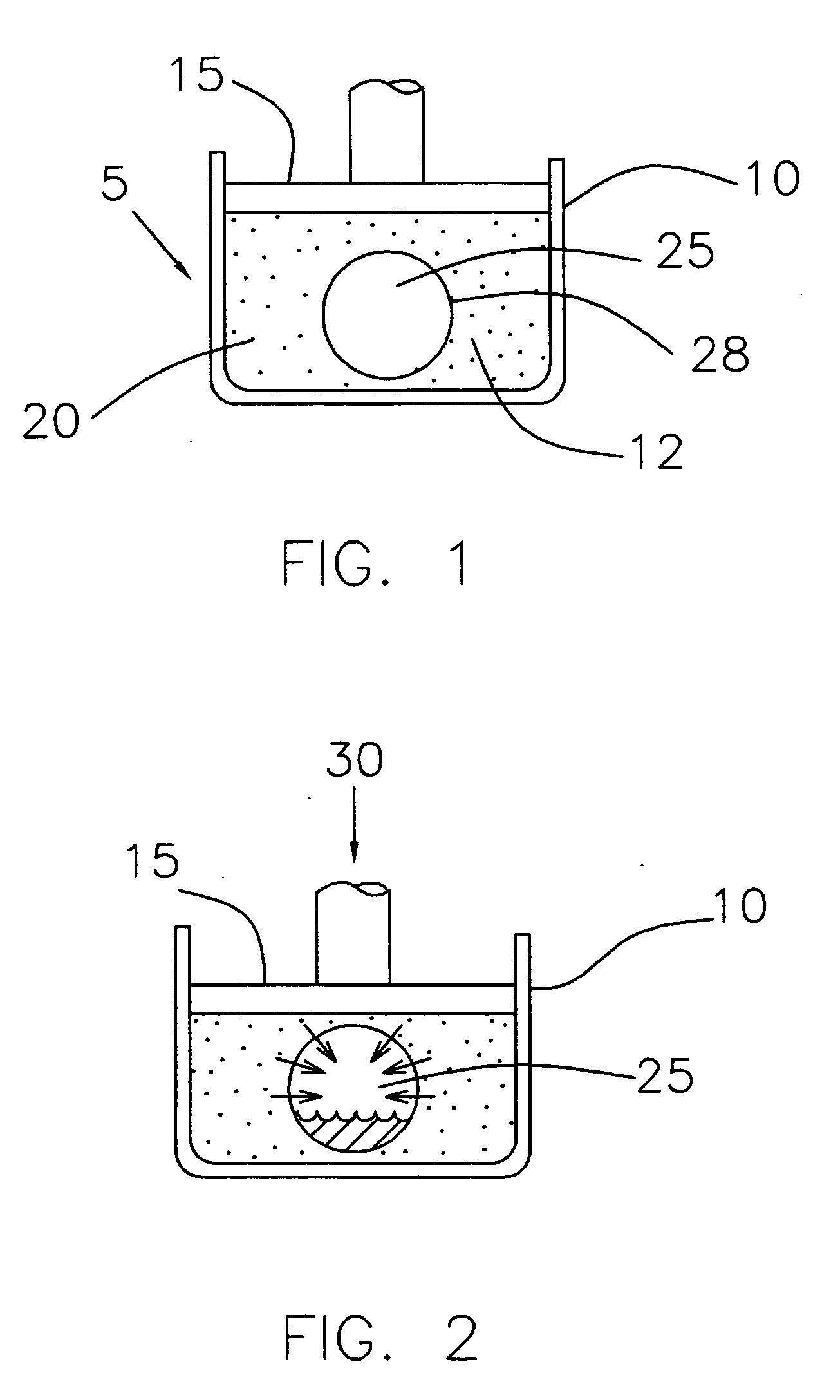 Closed system artificial intervertebral disc