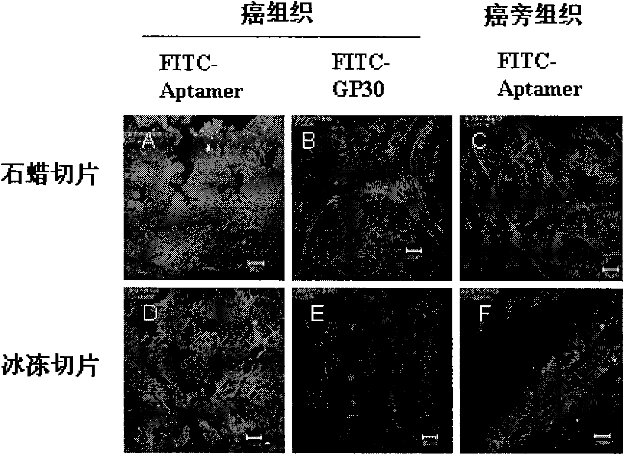 SELEX technology method taking clinical tumor pathological tissue section as target and application thereof