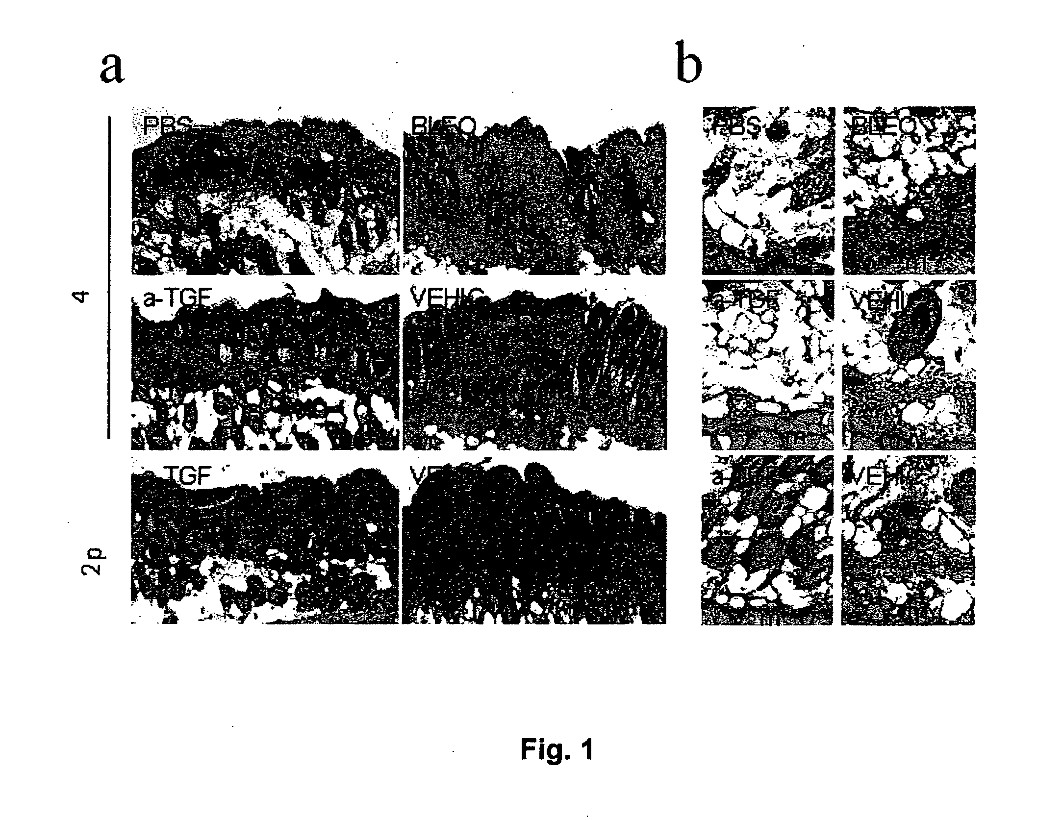 Method for the treatment of skin fibrosis and suitable compositions for such treatment