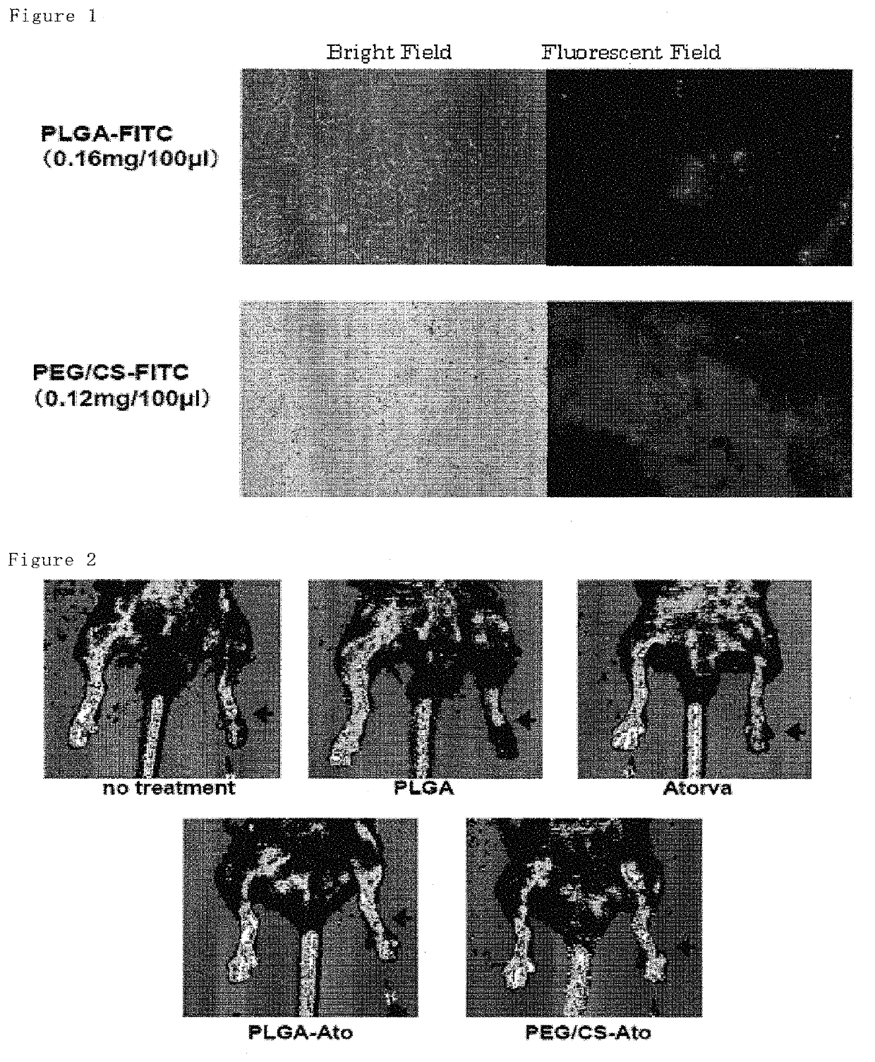 Pharmaceutical composition containing statin-encapsulated nanoparticle