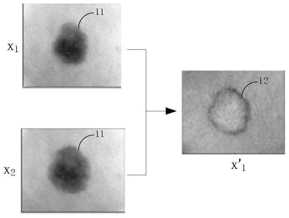 Dermatoscope image recognition method and device