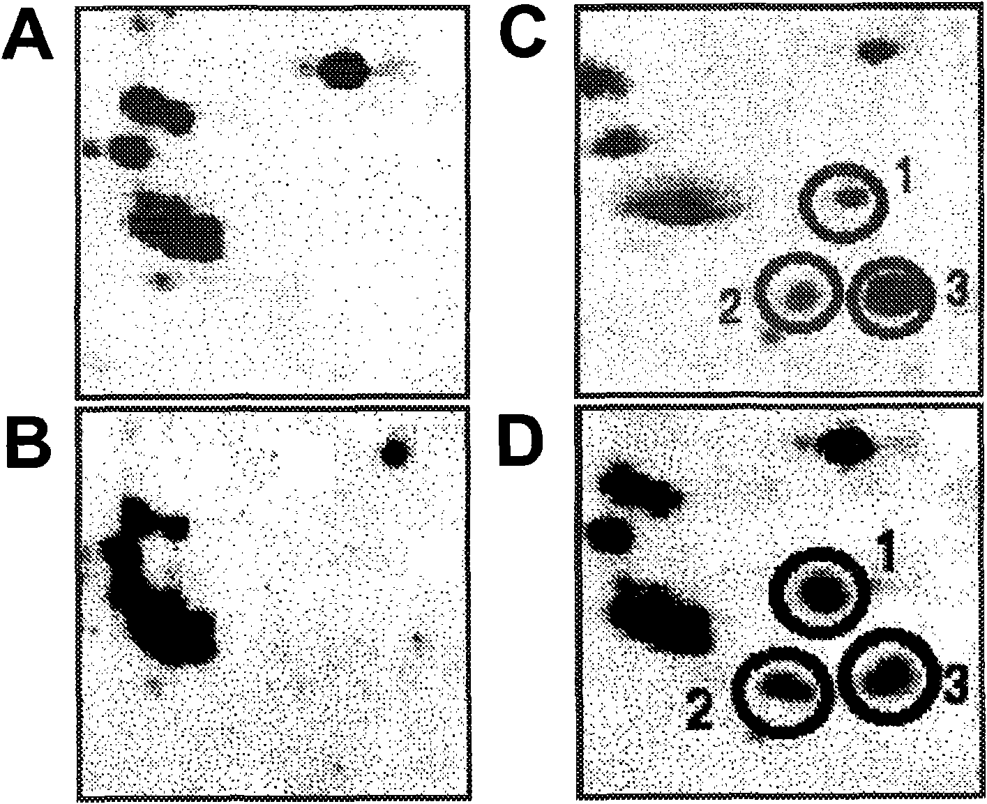 Methods of detecting autoantibodies for diagnosing and characterizing disorders