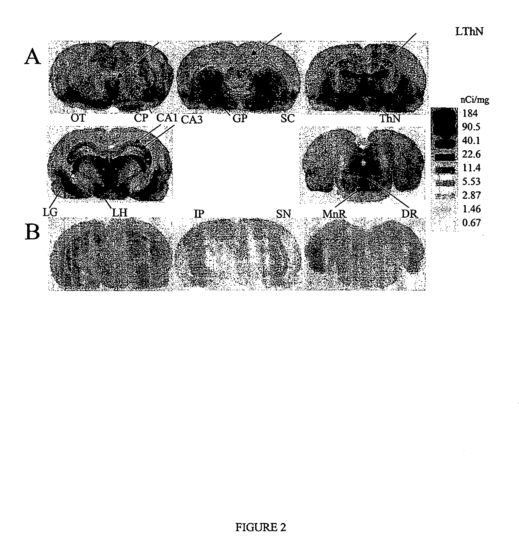 Diphenyl ether derivatives and their use for imaging serotonin transporters