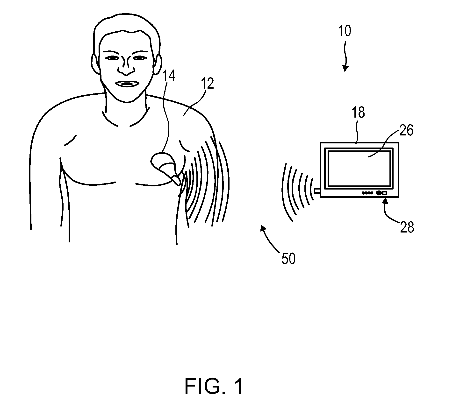 Mobile 3D wireless ultrasound image acquisition device and ultrasound imaging system