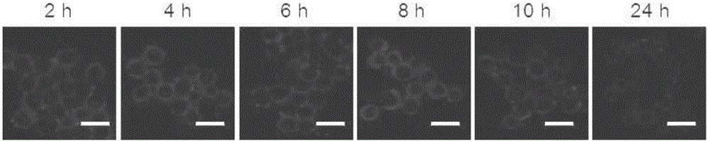 Tumor-targeting cell drug carrier and application thereof