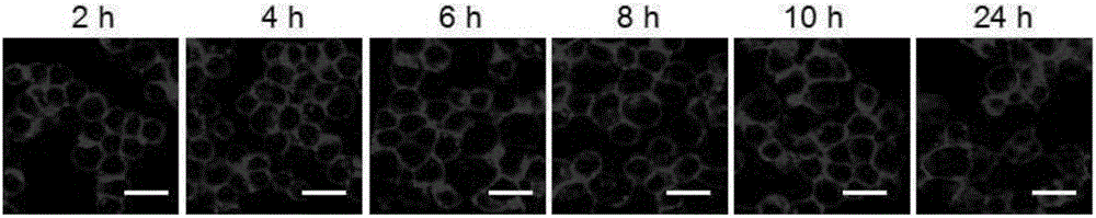 Tumor-targeting cell drug carrier and application thereof