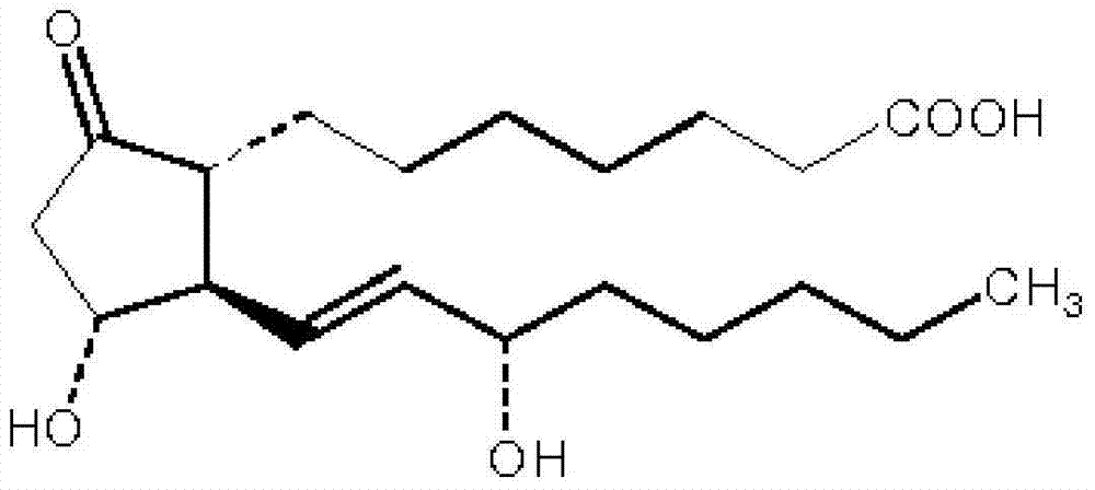 Alprostadil injection and preparation method thereof