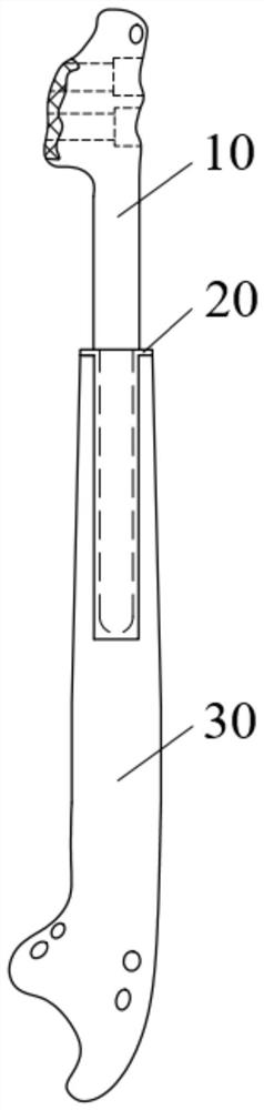 Ulna prosthesis