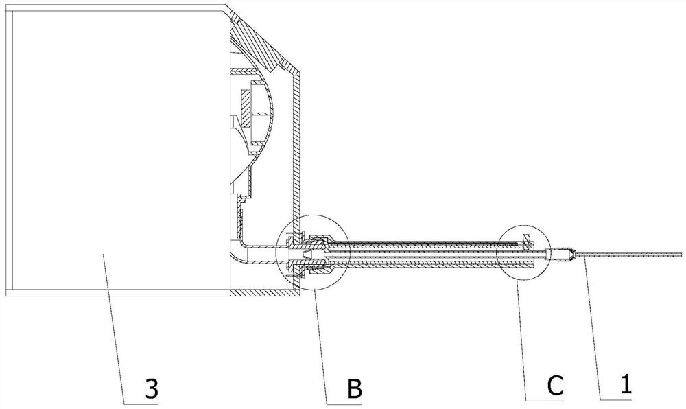 Nutrient solution conveying device for esophageal cancer