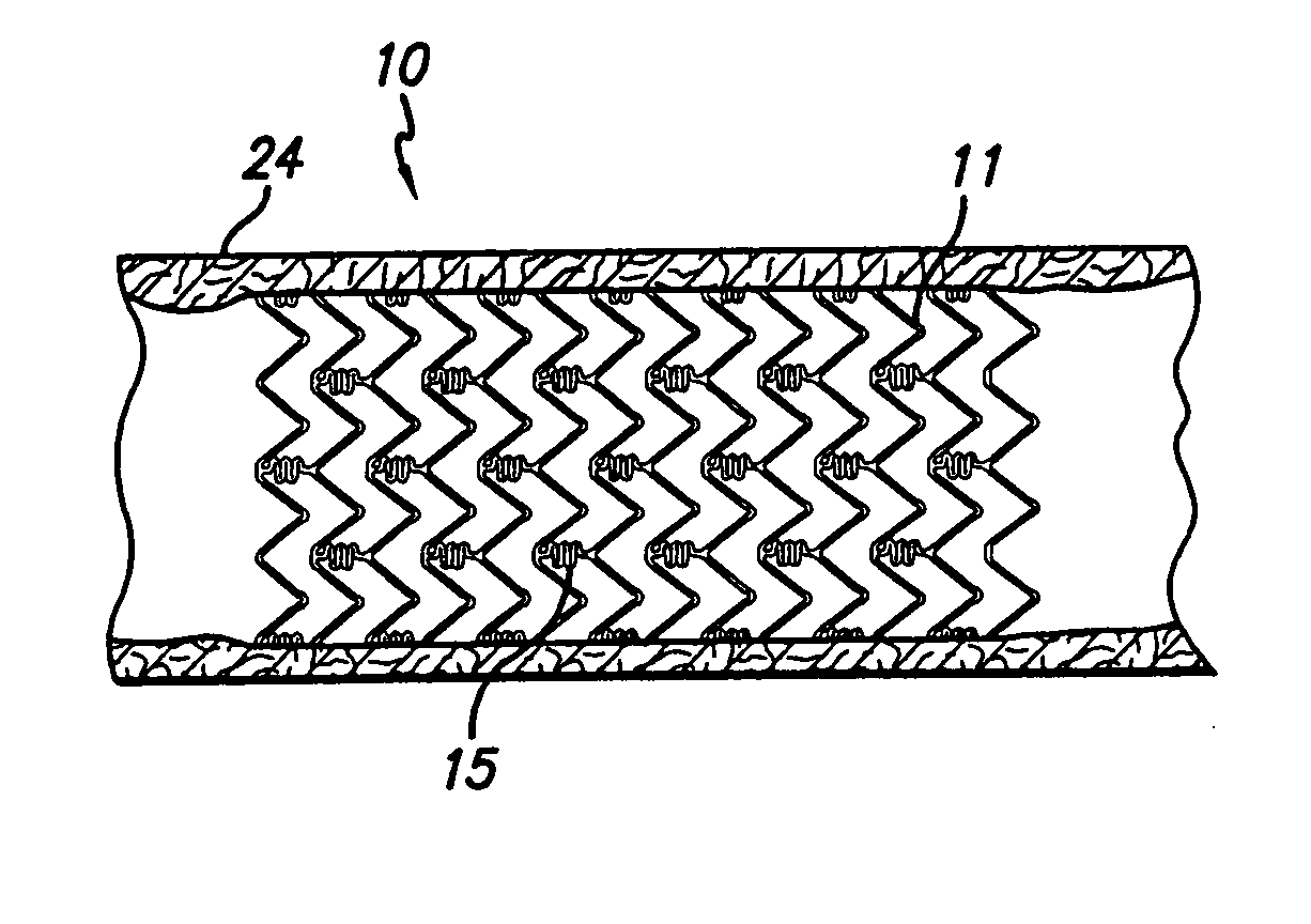 Degradable medical device