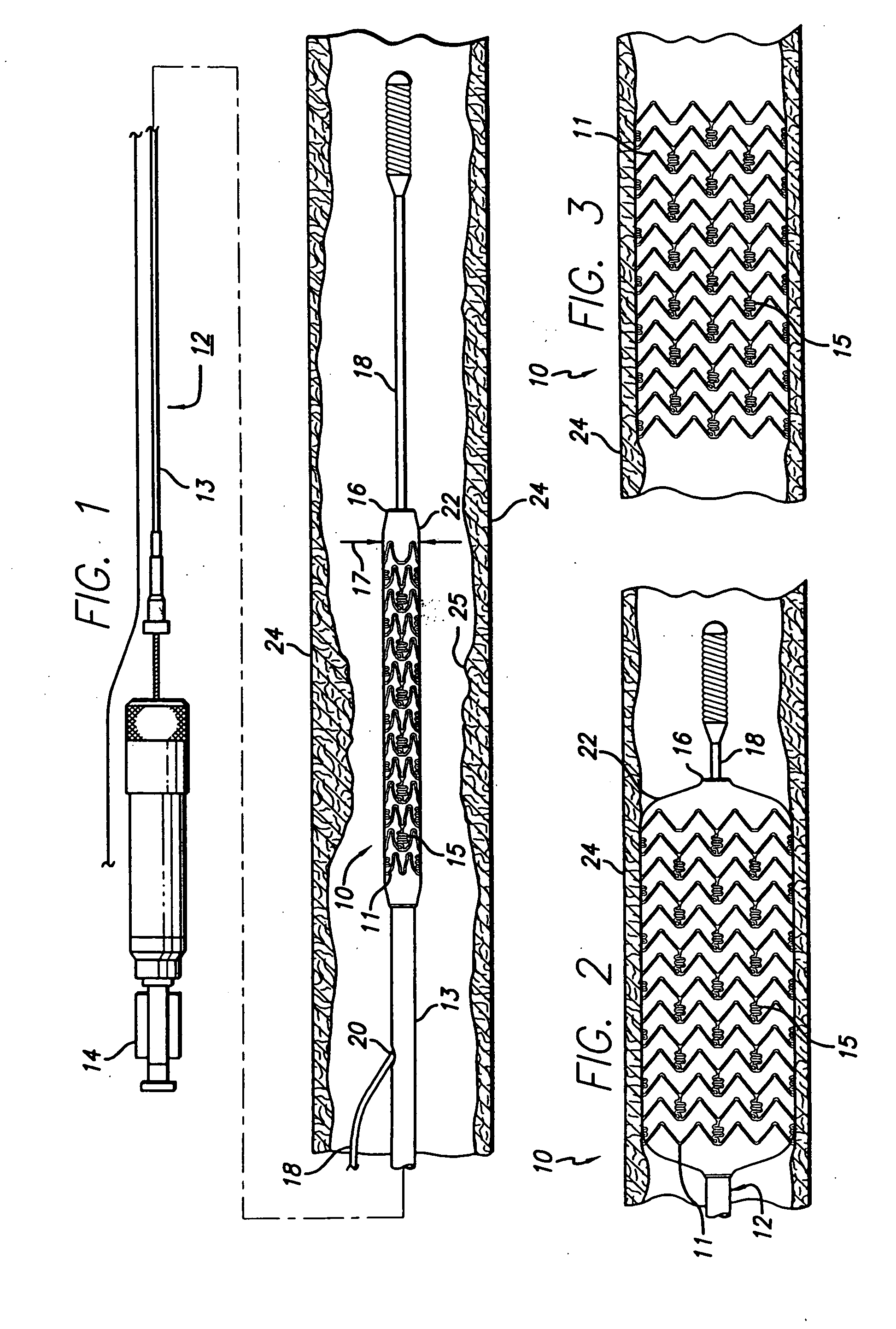 Degradable medical device