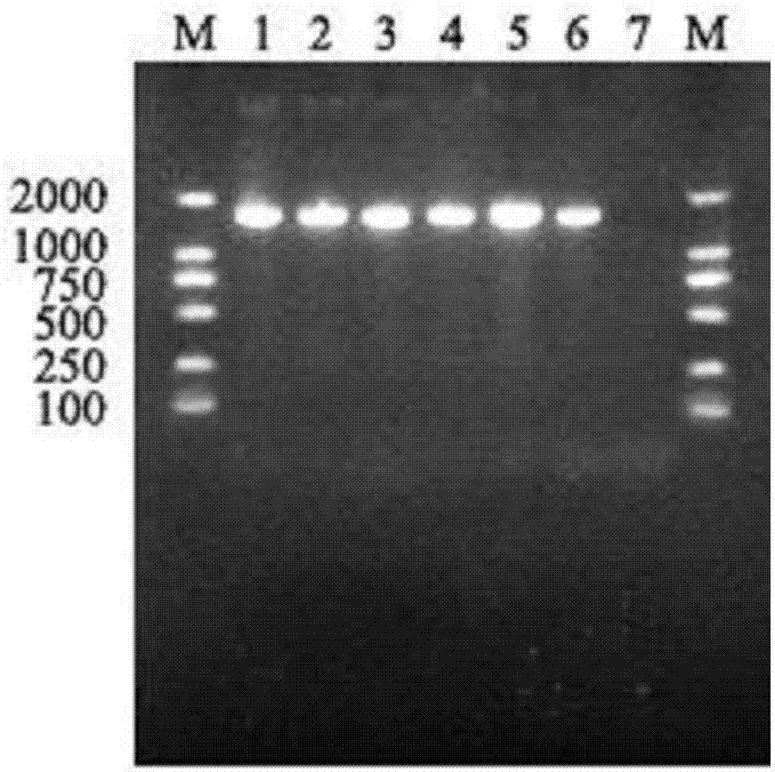 Streptococcus salivarius and application thereof in preparing ozostomia eliminating drug