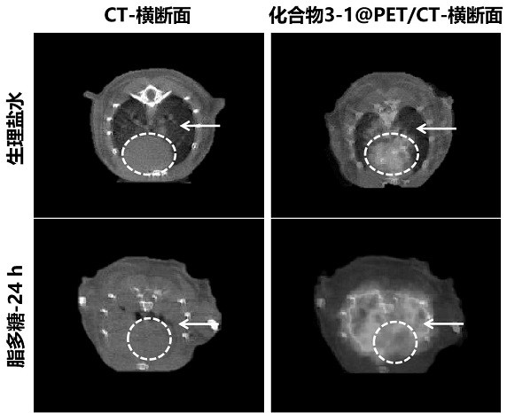 A class of radioactive PET imaging agents targeting interferon gene stimulators