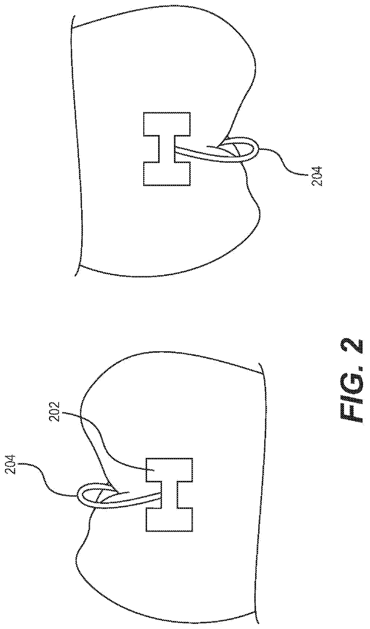 Ceramic processing for the direct manufacture of customized labial and lingual orthodontic brackets