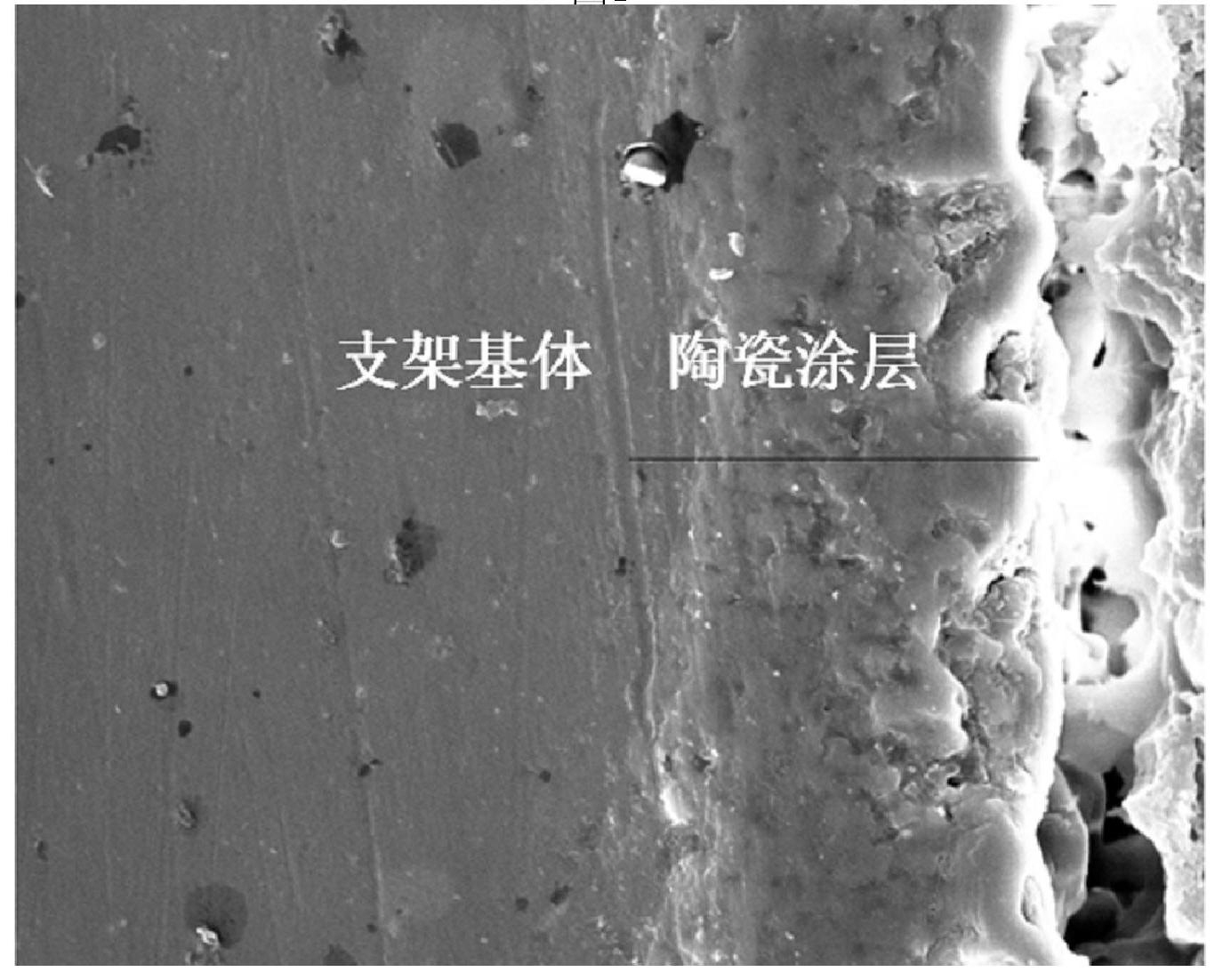 Corrosion-resistant magnesium alloy bracket and preparation method thereof