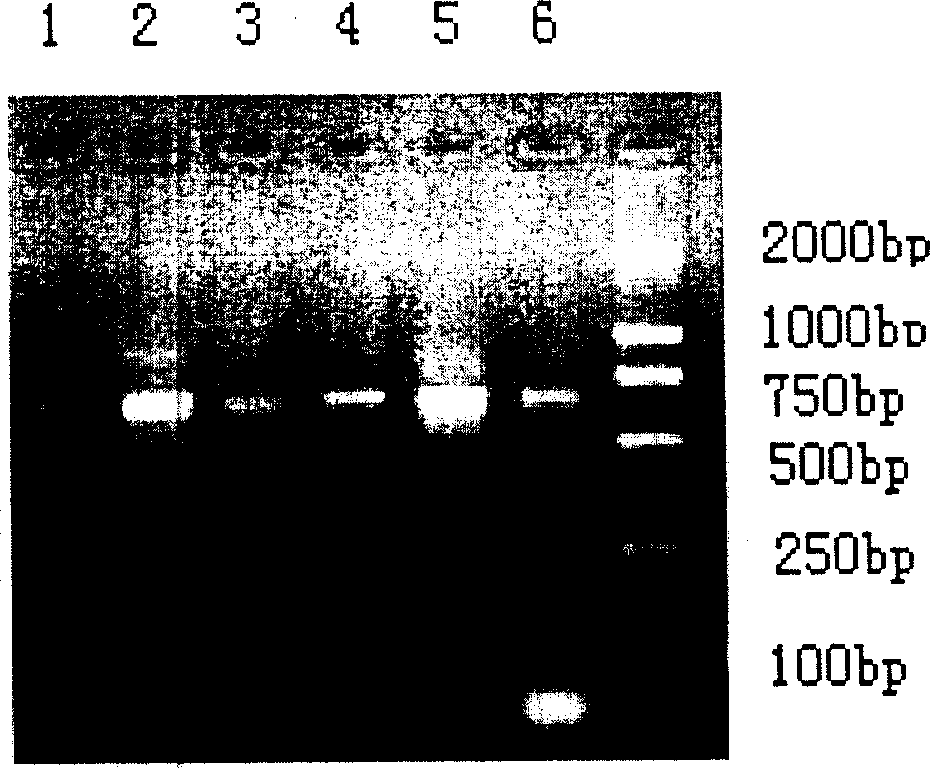 Human source anti- tetanus exotoxin antibody and preparation method and use thereof