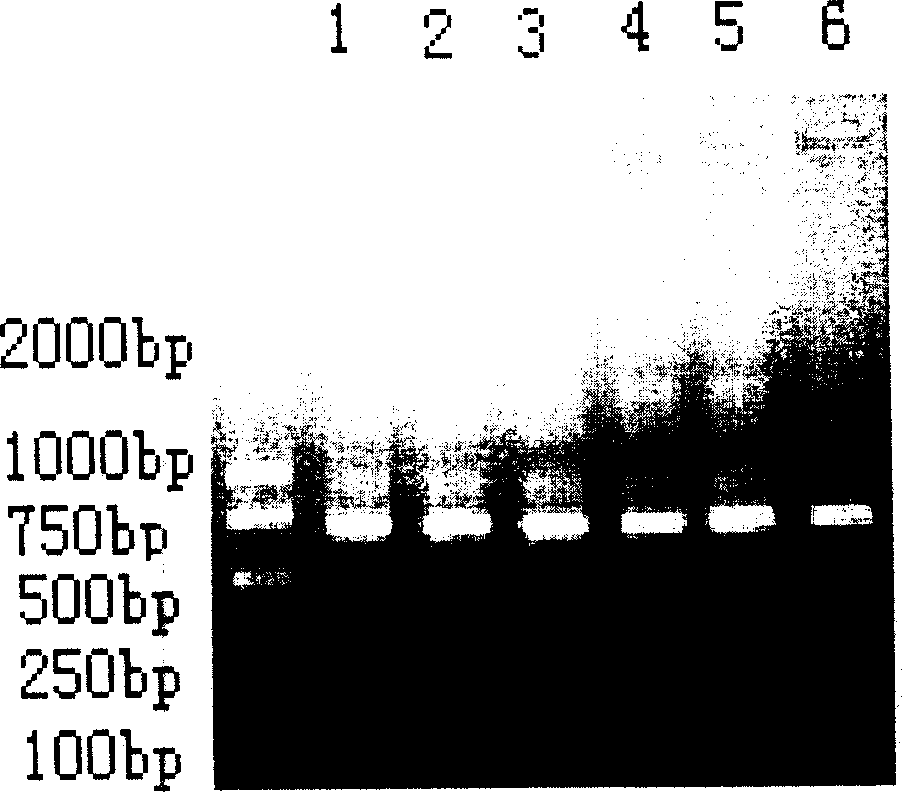 Human source anti- tetanus exotoxin antibody and preparation method and use thereof