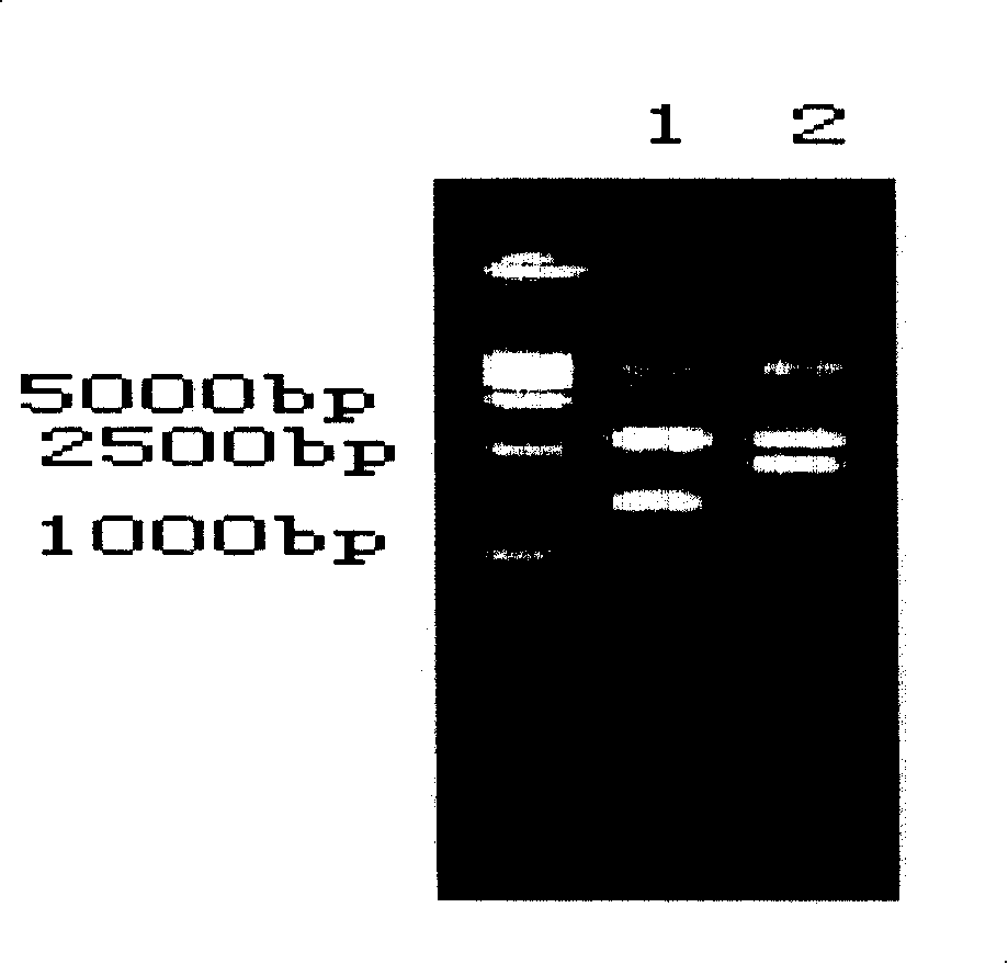 Human source anti- tetanus exotoxin antibody and preparation method and use thereof