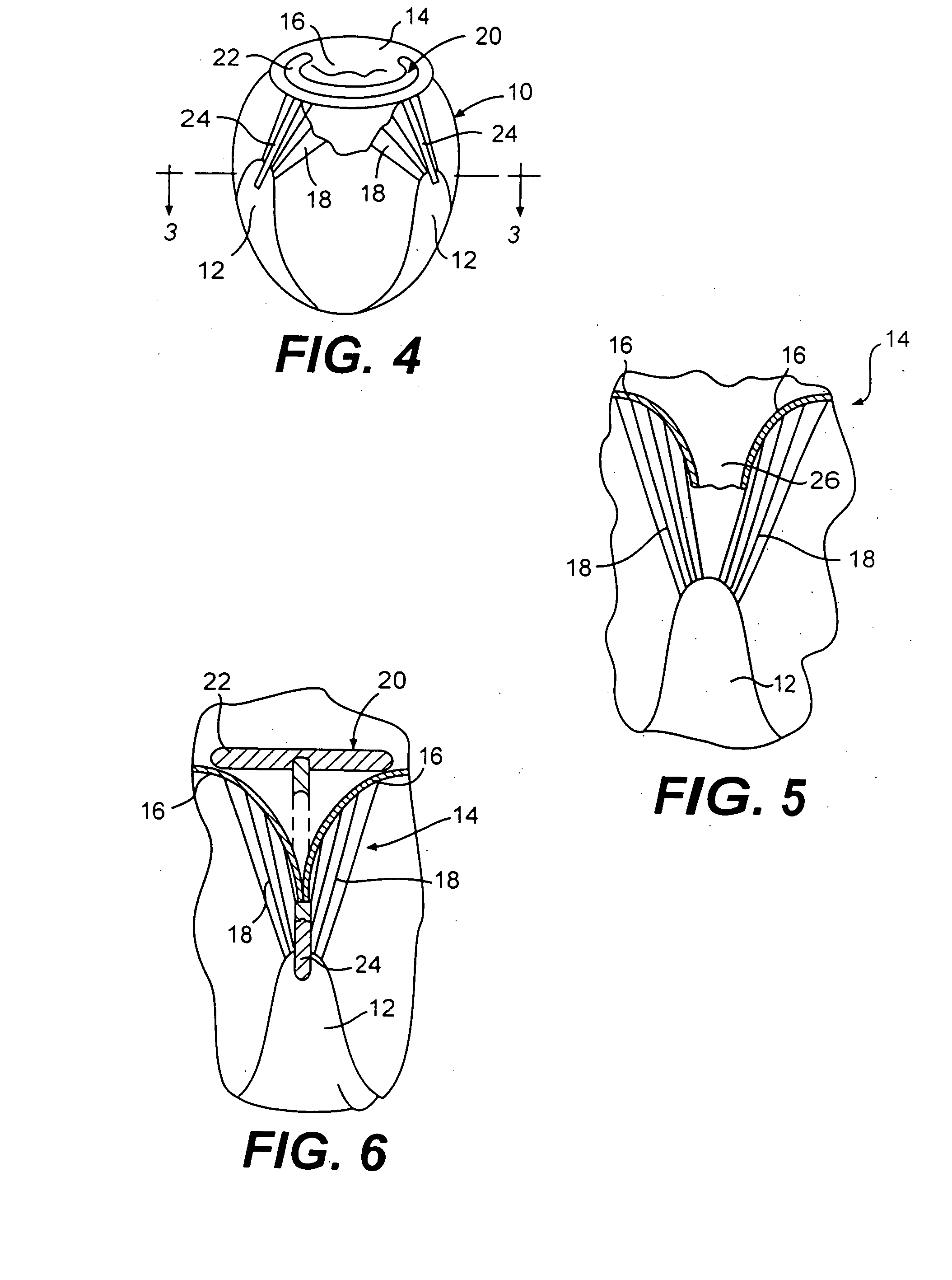 Valve to myocardium tension members device and method