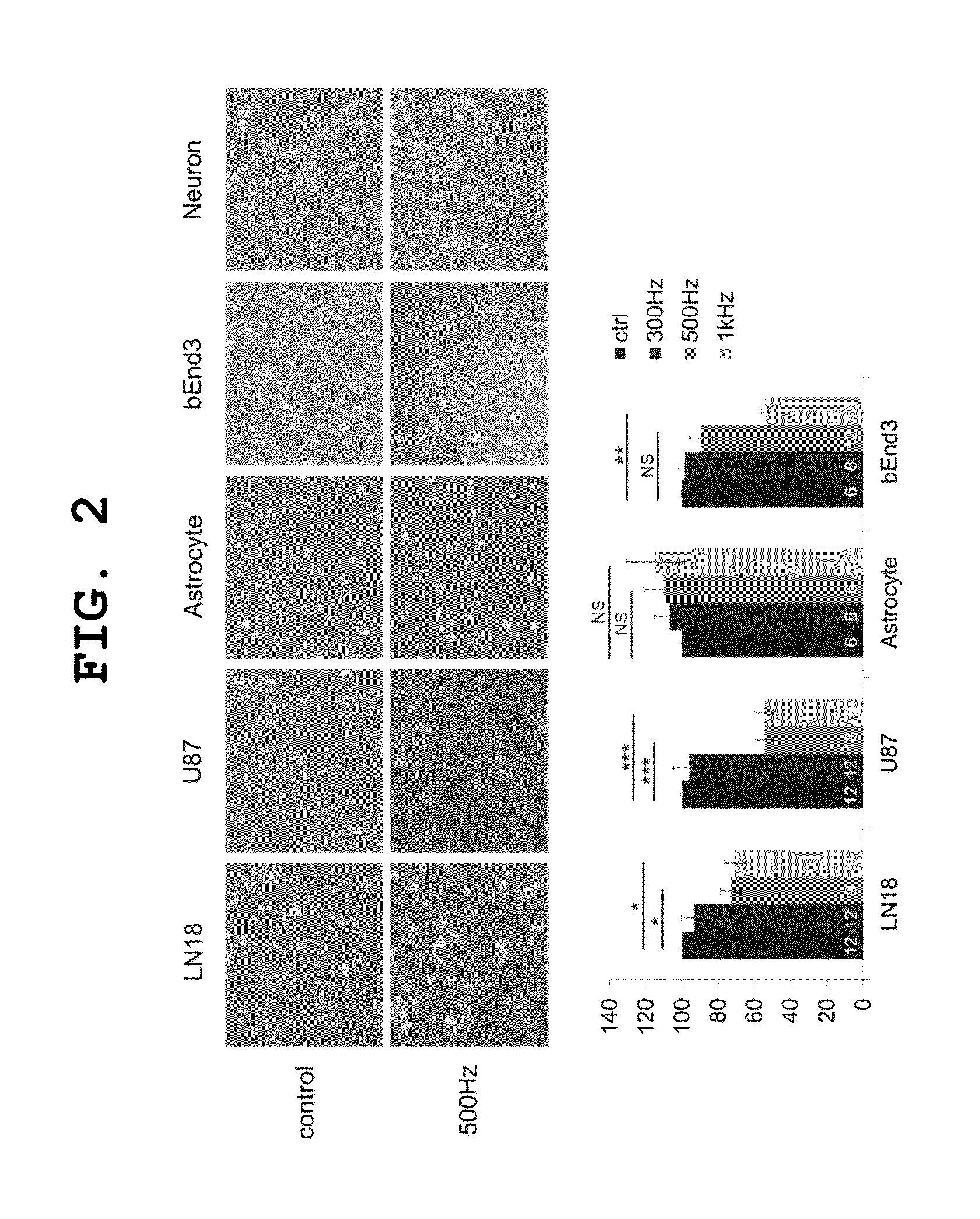 Alternative magnetic stimulating system for preventing or treating brain tumor growth