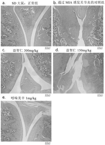 Composition containing alpinia oxyphylla extract as active ingredient for prevention, alleviation, or treatment of osteoarthritis