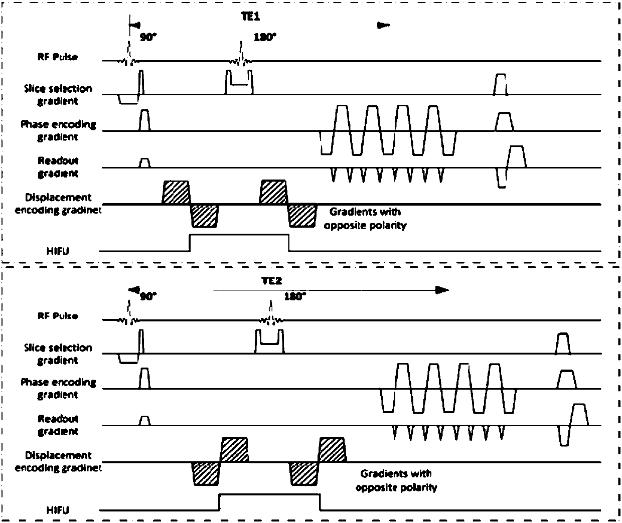 Method and device for synchronously detecting tissue displacement and T2