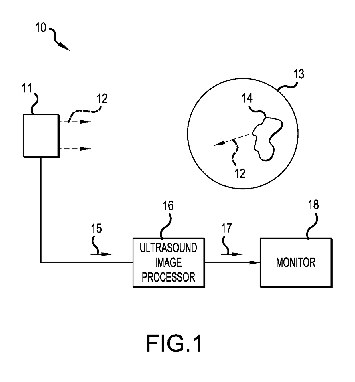 Methods and systems for automatic control of subjective image quality in imaging of objects