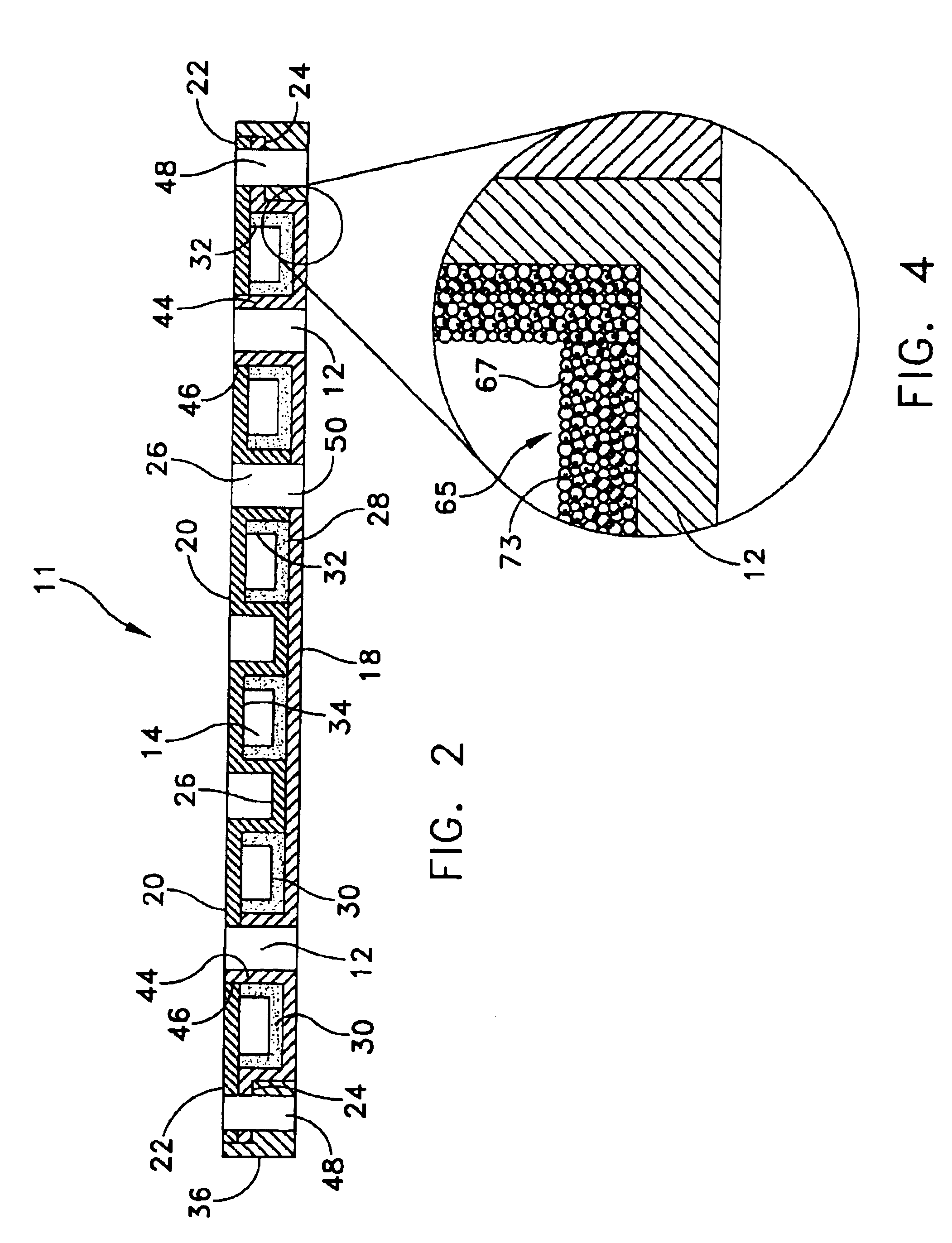 Integrated circuit heat pipe heat spreader with through mounting holes