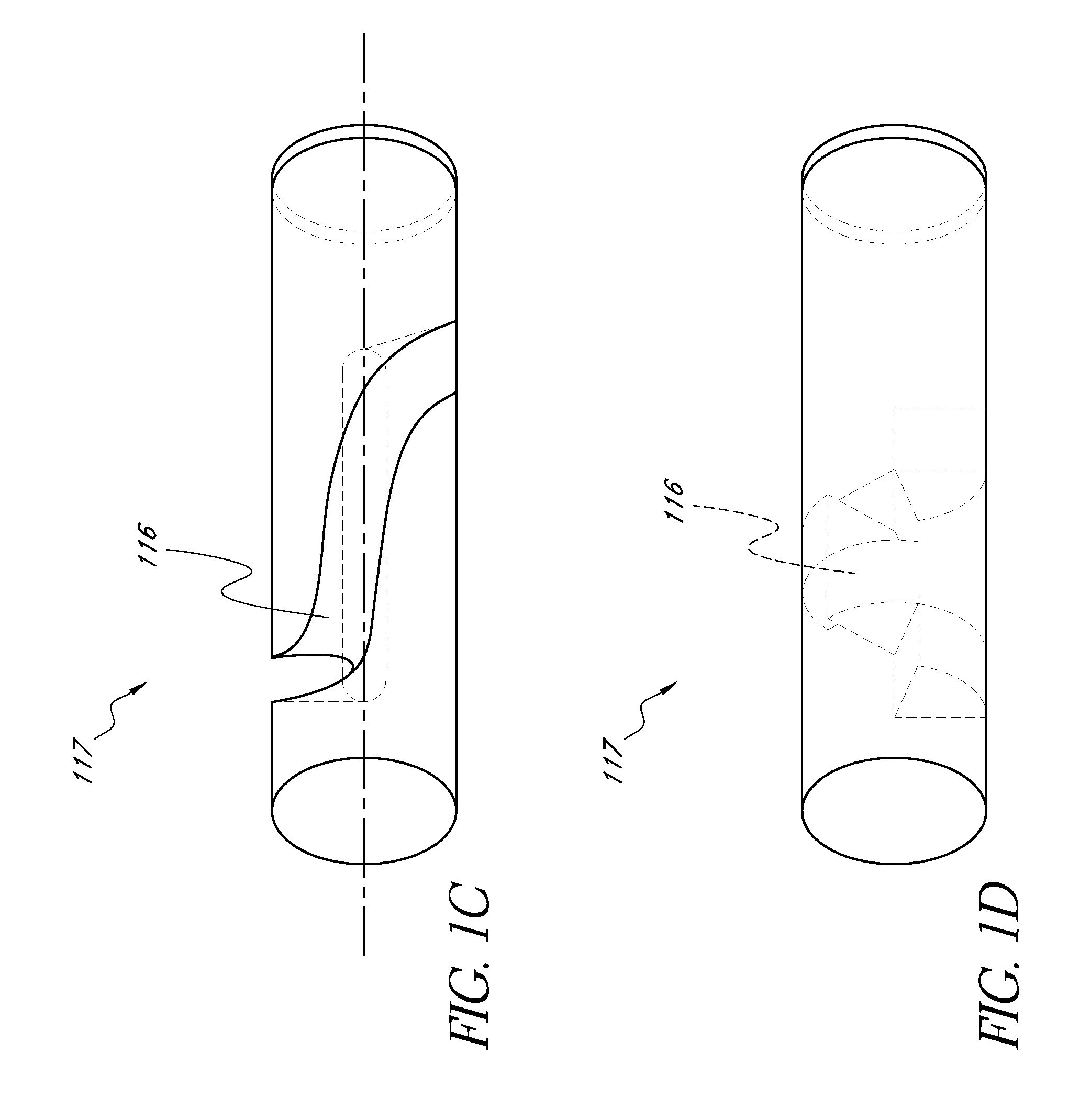 Optical sensor configuration for ratiometric correction of blood glucose measurement