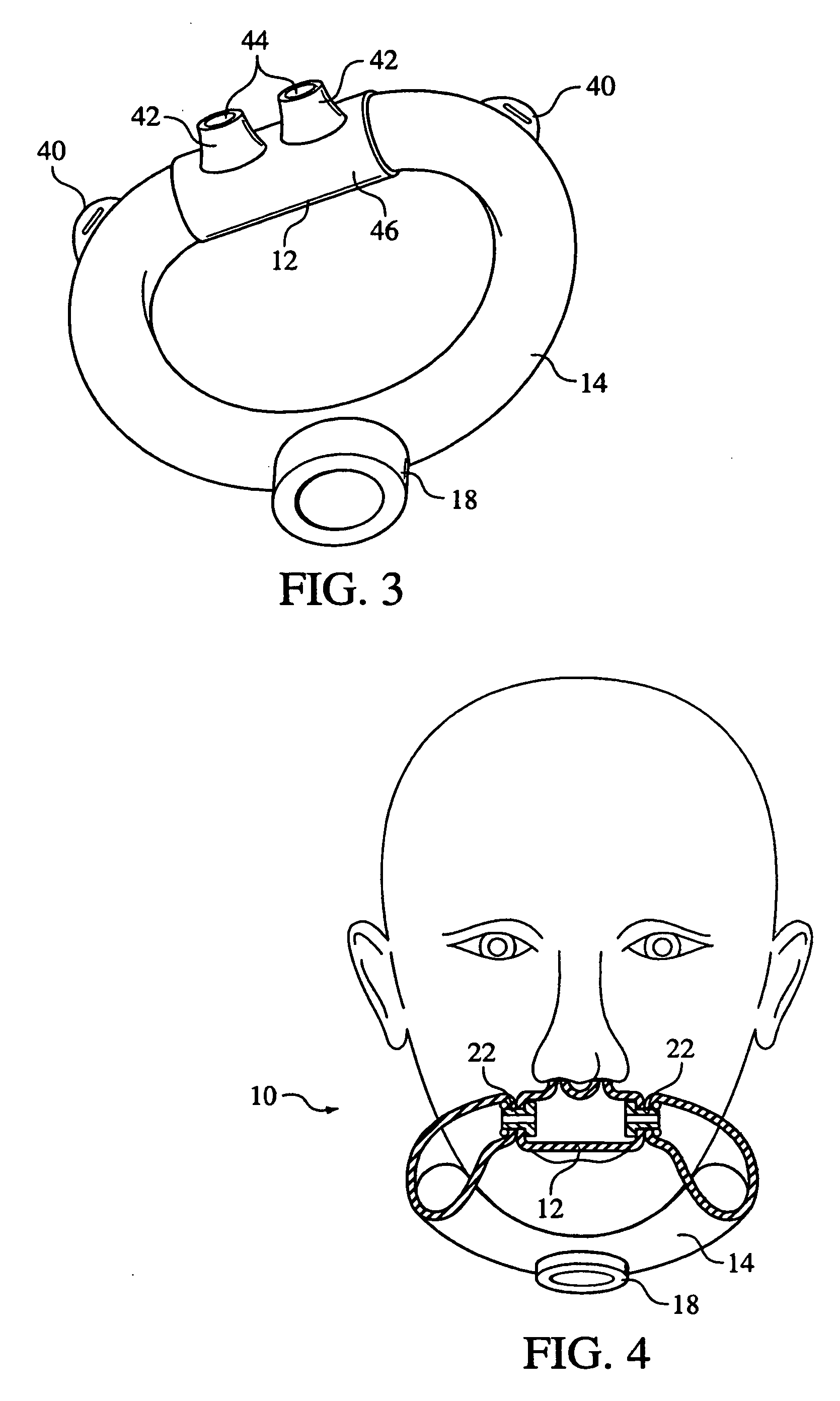 Patient intreface assembly supported under the mandible