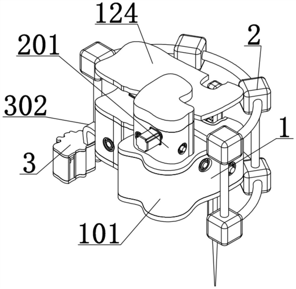 An emergency hemostasis device before gastric bleeding operation