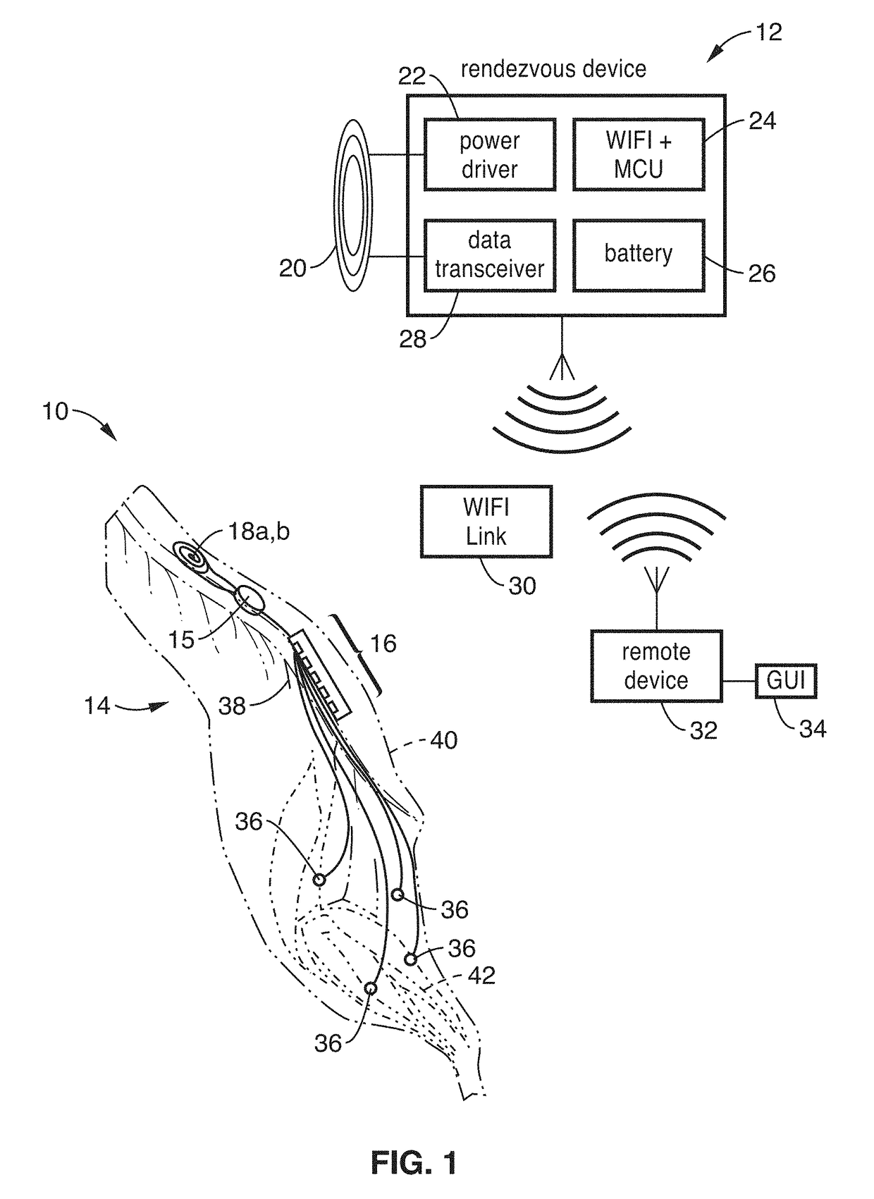 Wireless implant for motor function recovery after spinal cord injury