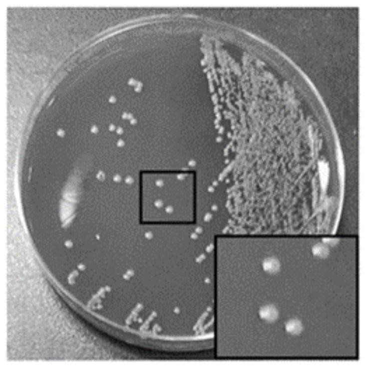 Application of microorganism containing 3 beta-steroid dehydrogenase gene as marker of male depression