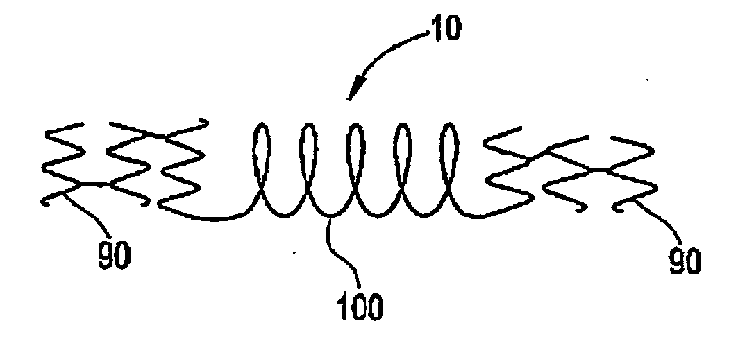 Hybrid stent