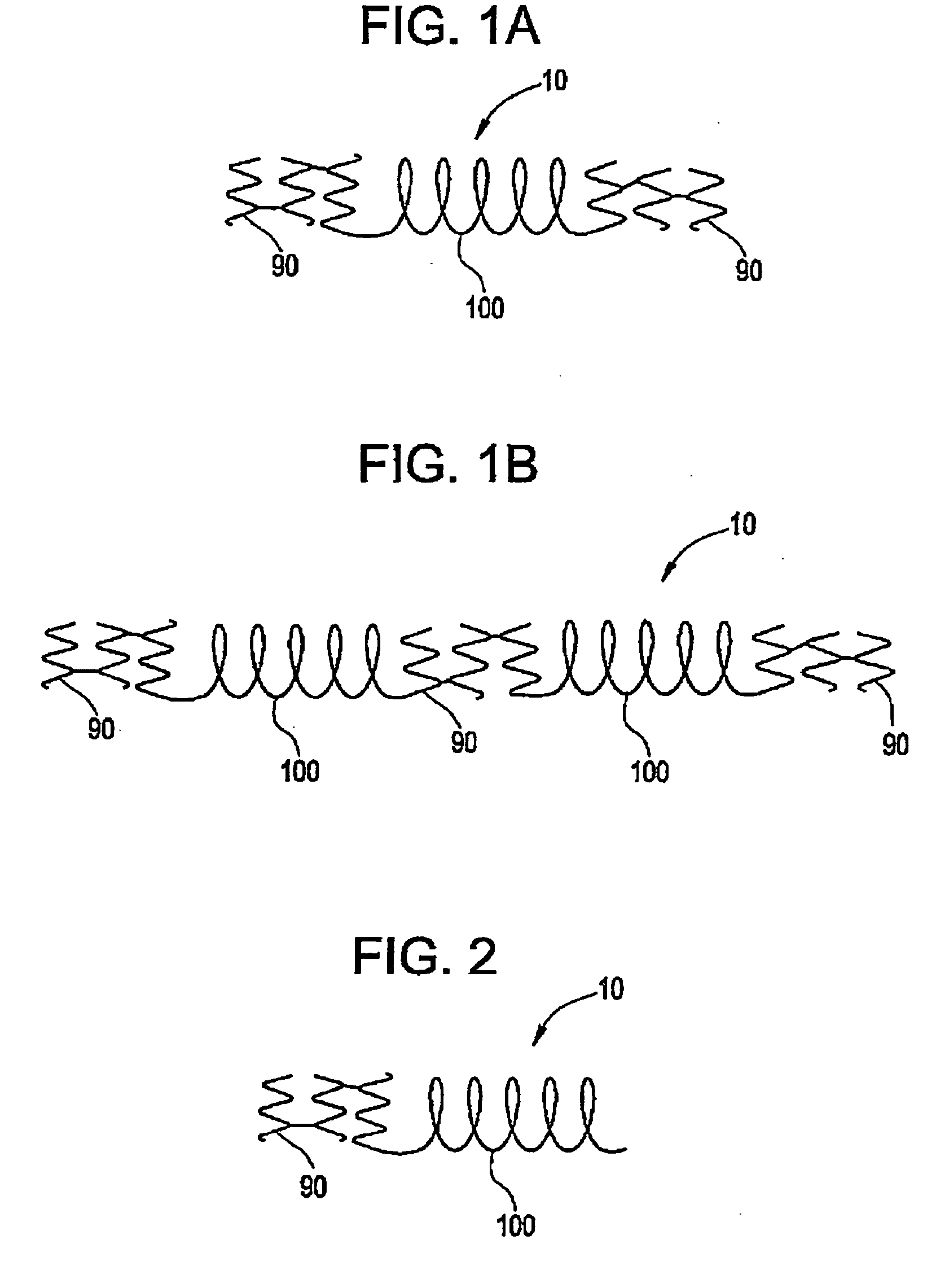 Hybrid stent