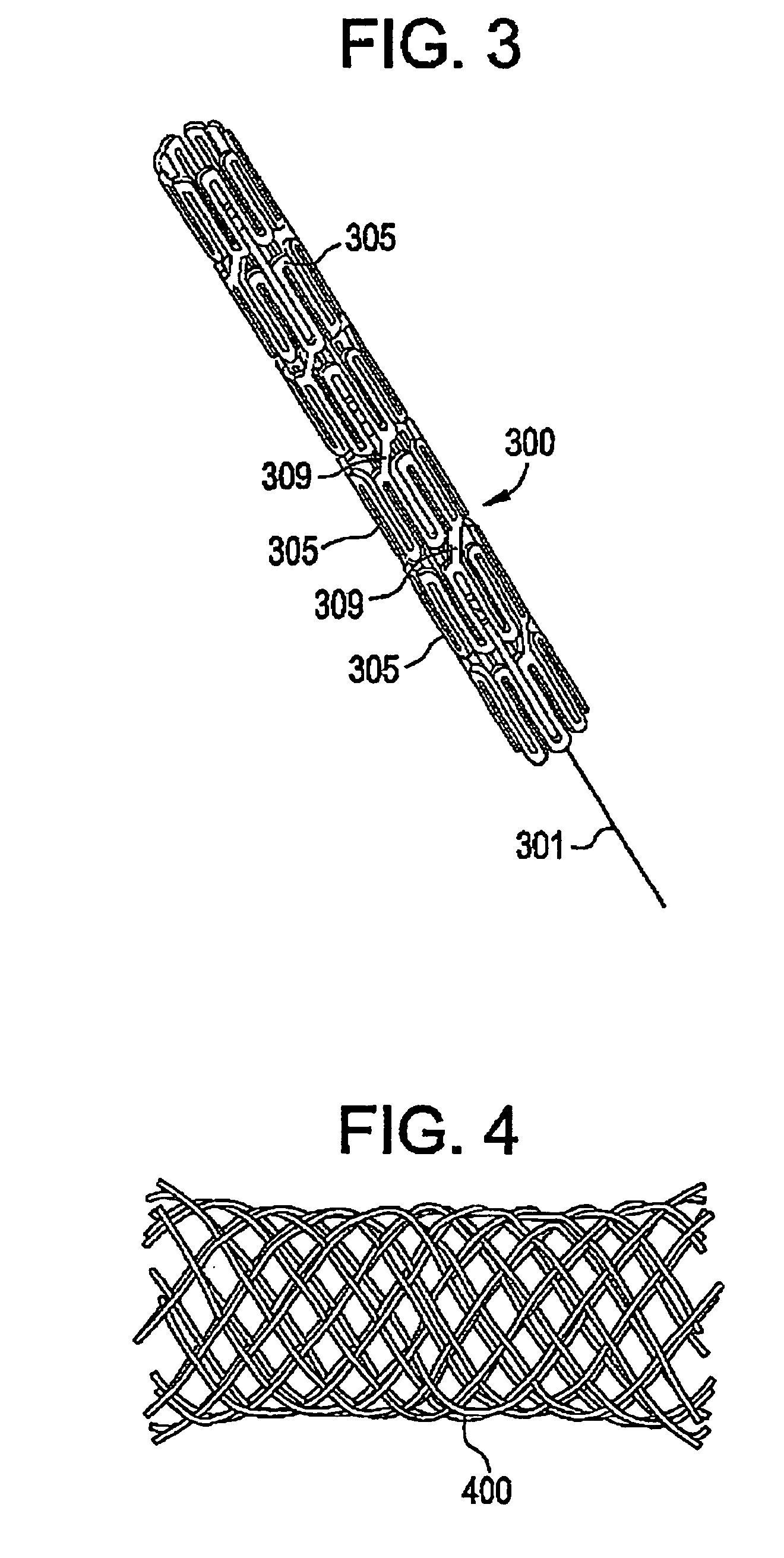 Hybrid stent