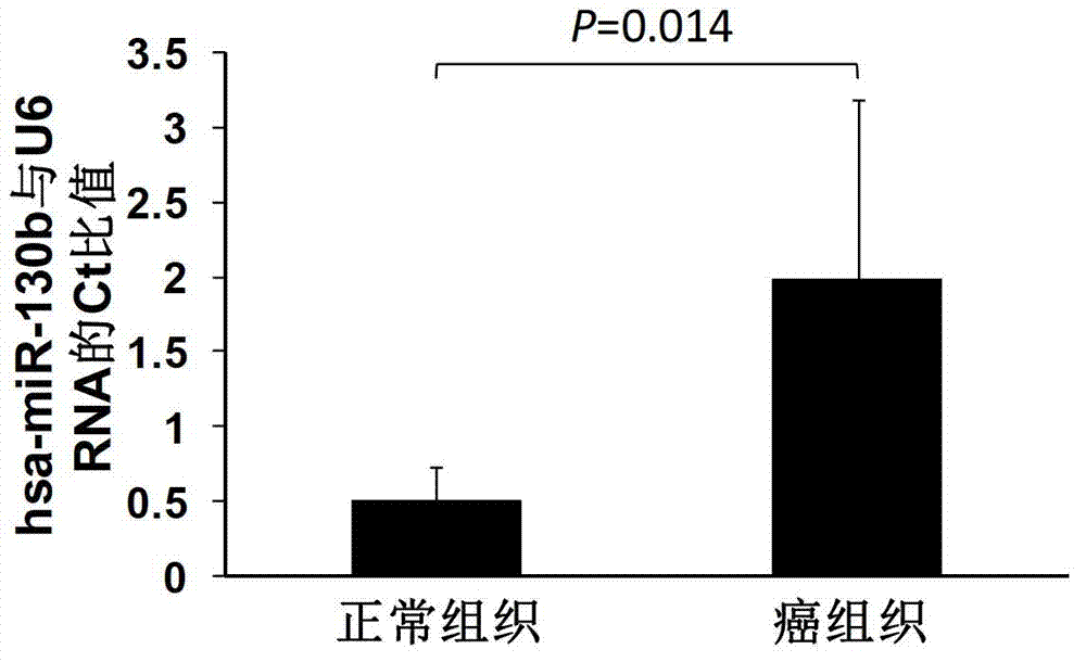 Small RNA used for regulating expression of B7-H2 gene