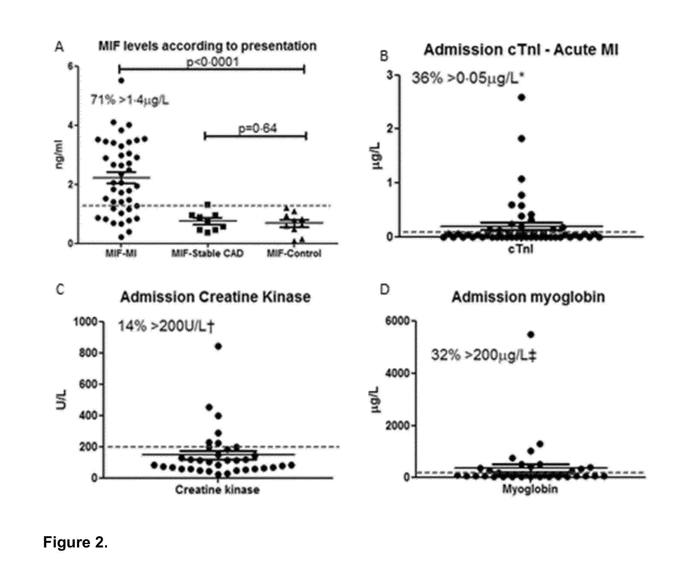 Method for diagnosis, prognosis or treatment of acute coronary syndrome (ACS) comprising measurement of plasma concentration of macrophage migration inhibitory factor (MIF)