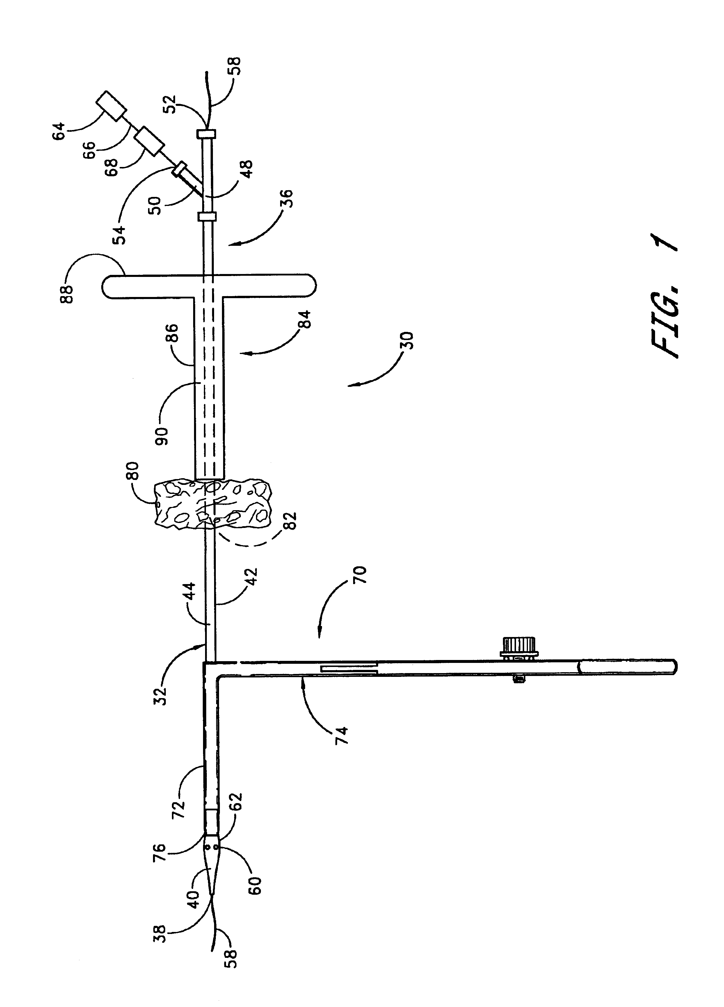 Method and apparatus for closing vascular puncture using hemostatic material