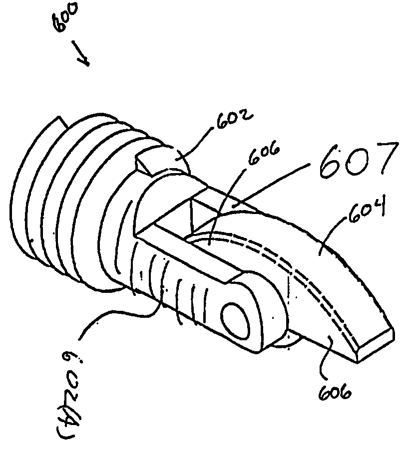 Bone fasteners and method for stabilizing vertebral bone facets using the bone fasteners