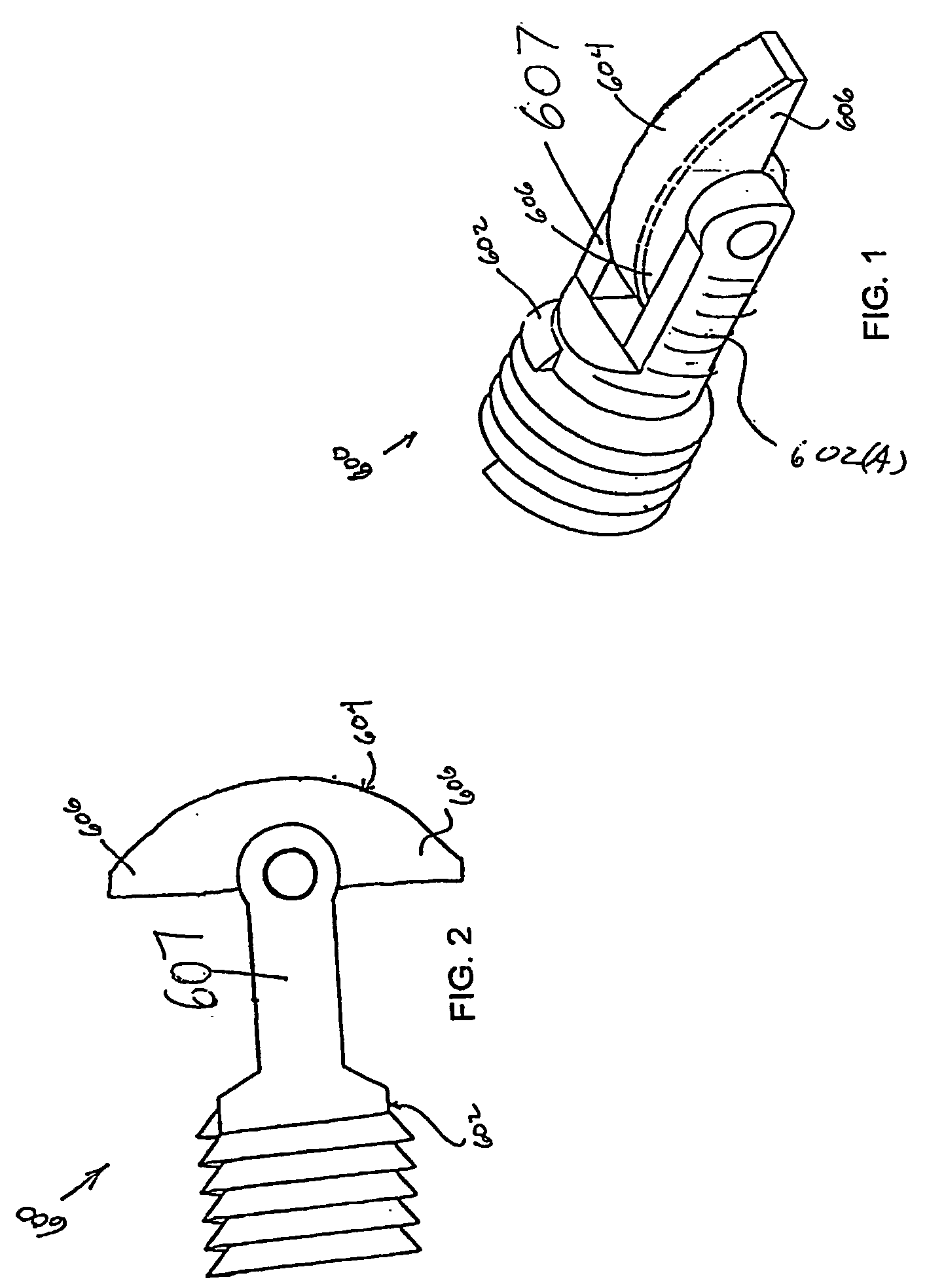 Bone fasteners and method for stabilizing vertebral bone facets using the bone fasteners