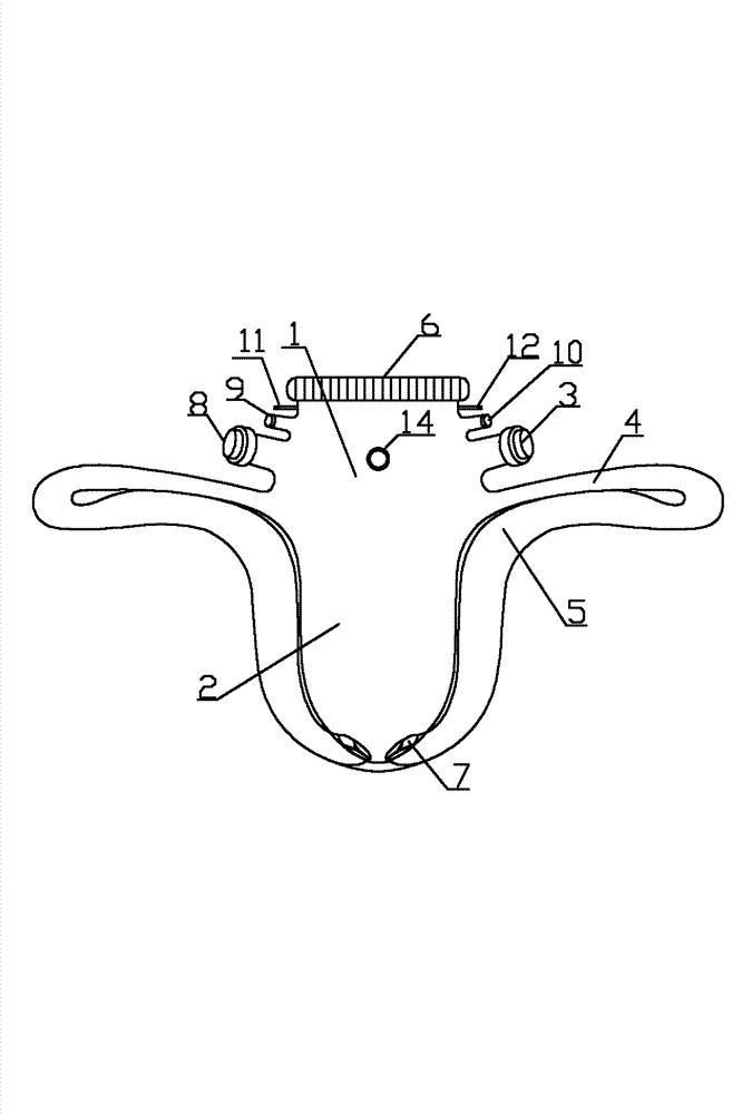 Potential difference circulating bioreactor