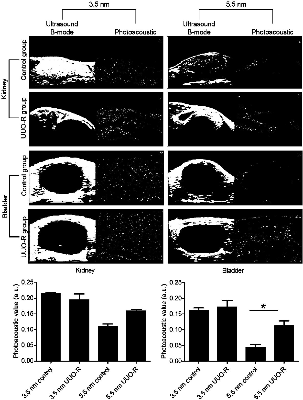 Use of nanometer gold probe to preparation of early diagnosis reagent for kidney injury