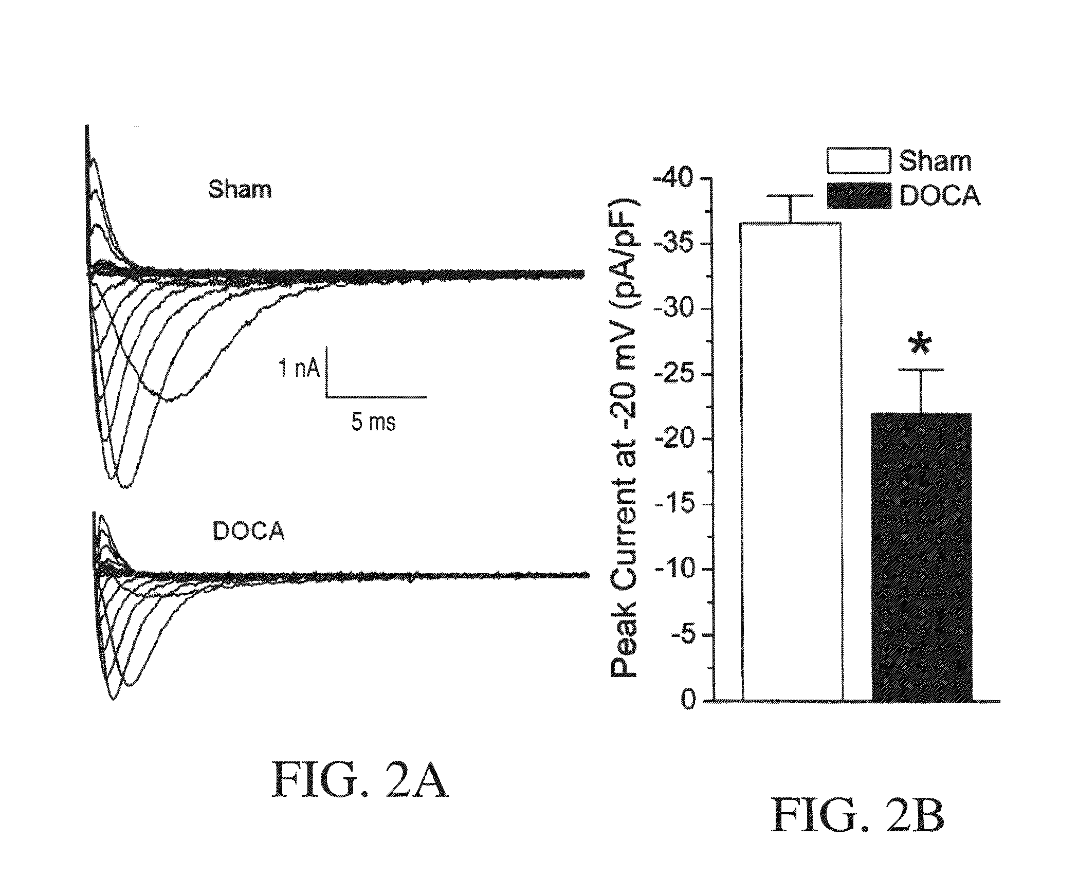 Method for Ameliorating or Preventing Arrhythmic Risk Associated with Cardiomyopathy